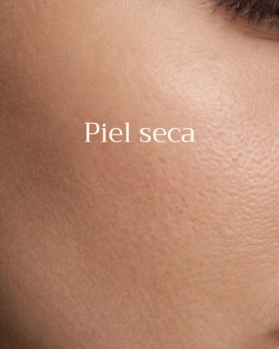 Piel Seca