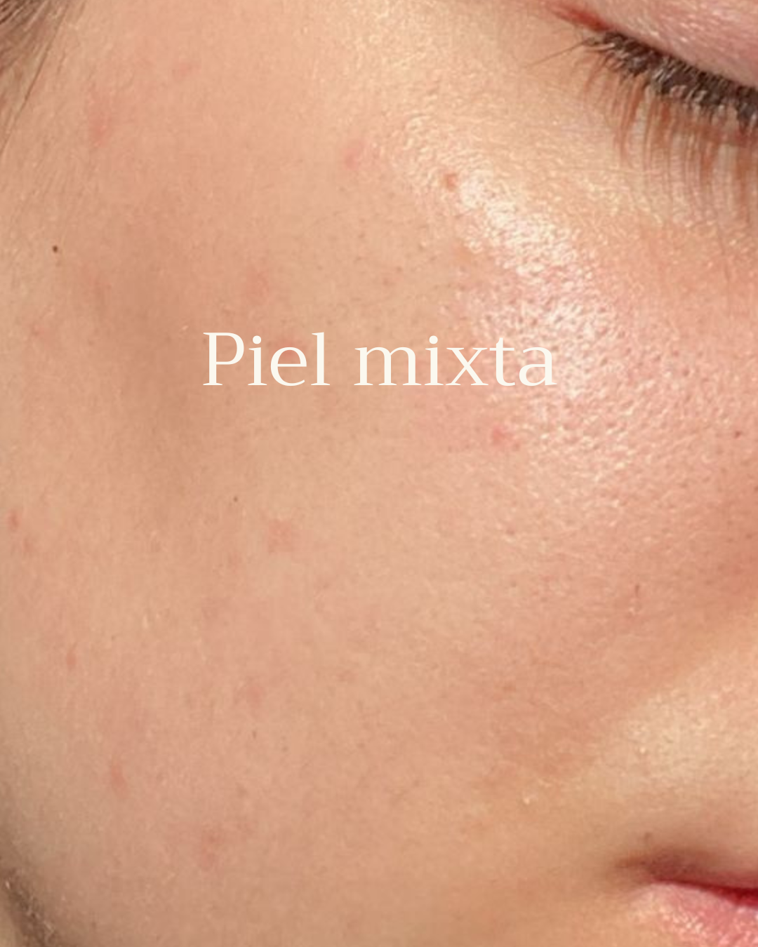 Piel Mixta